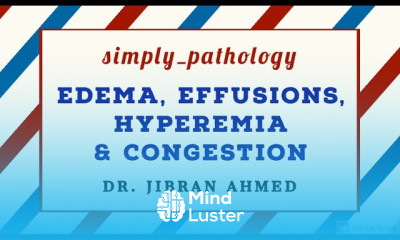 Thrombosis Disorders