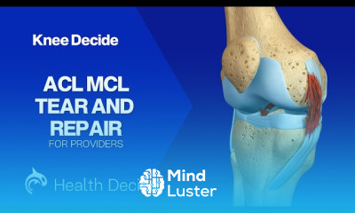 Anterior Cervical Discectomy and Fusion ACDF