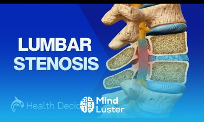 Vertebral Compression Fractures treatment