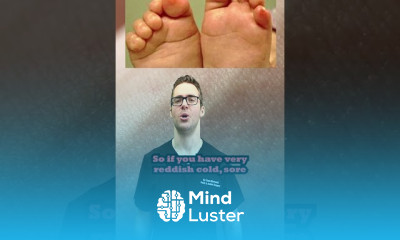 Toenail fungal Symptoms and treatment