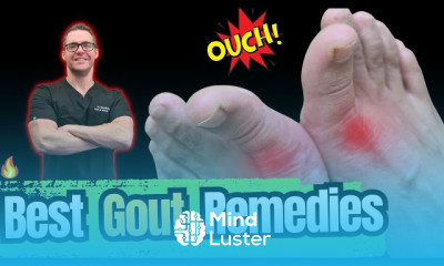 Gout Causes and Treatment