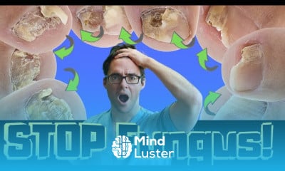 Toenail Fungus types and treatments