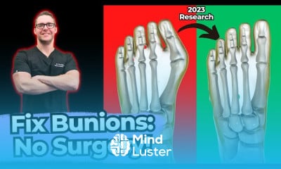 Turf Toe Injury Causes and treatment