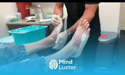 Custom Orthotics Mold Casting techniques