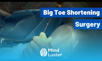 Big Toe Shortening Surgery techniques