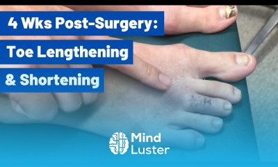 Short Toe Lengthening and Long Toe Shortening