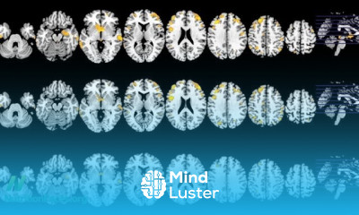 Hormones effects in milk on Infertility
