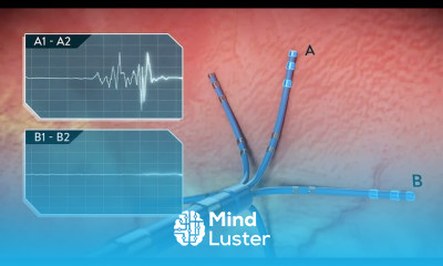 Cardiac electrophysiology systems techniques