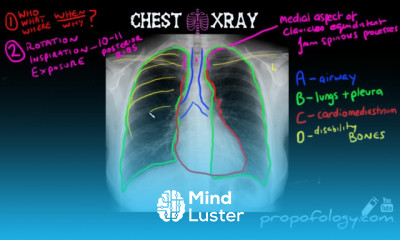Chest X Ray techniques