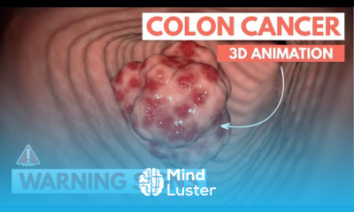 Cancer warning signs and symptoms