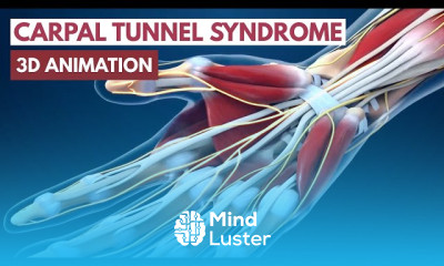 Carpal tunnel syndrome causes