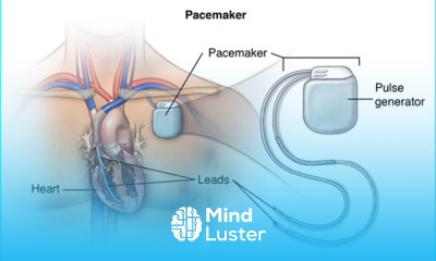 Pacemaker troubleshooting fundamentals