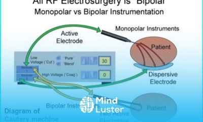 Cautery machine working principles