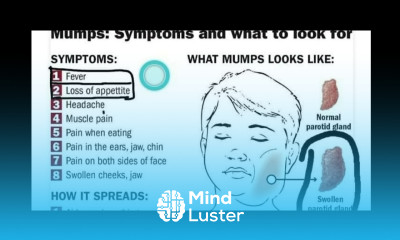 Mumps Virus Symptoms How Spreads