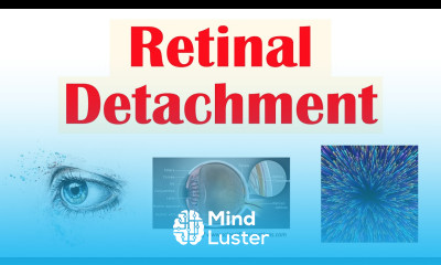 Retinal Detachment Types Risk Factors Pathophysiology Signs Symptoms Diagnosis Treatment