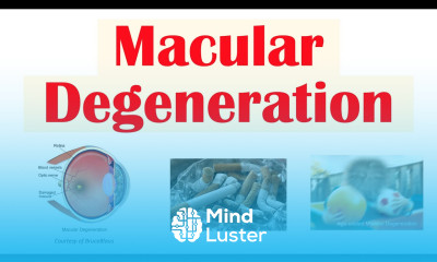 Macular Degeneration Wet vs Dry Risk Factors Pathophysiology Symptoms Diagnosis Treatment