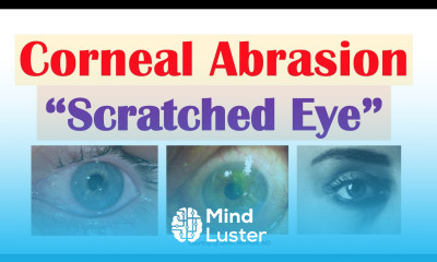 Corneal Abrasion “Scratched Eye” Causes Signs Symptoms Diagnosis Treatment
