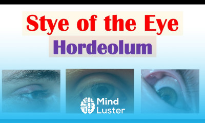 Eye Stye Hordeolum Causes Symptoms Diagnosis At Home Treatments