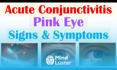 Conjunctivitis Signs Symptoms Allergic Bacterial and Viral Why Symptoms Occur
