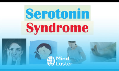 Serotonin Syndrome Causes Medications Pathophysiology Signs Symptoms Diagnosis Treatment