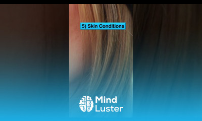 Swimmer s Ear Otitis Externa Risk Factors Causes