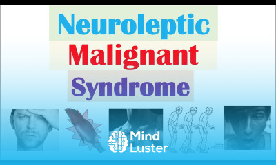 Neuroleptic Malignant Syndrome Causes Pathophysiology Symptoms Diagnosis Treatment