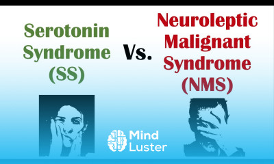 Serotonin Syndrome vs Neuroleptic Malignant Syndrome Similarities Differences
