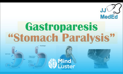 Gastroparesis Stomach Paralysis Causes and Risk Factors Signs Symptoms Diagnosis Treatment