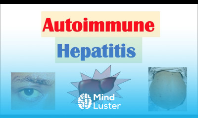 Autoimmune Hepatitis Pathogenesis Signs Symptoms Diagnosis Treatment