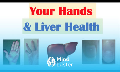 Your Hands Liver Health What Your Hands Can Tell You About Your Liver Health