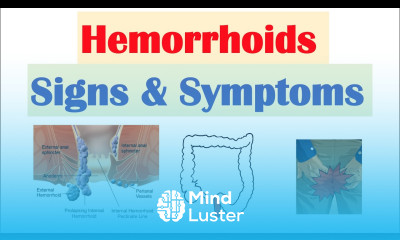 Hemorrhoids Signs Symptoms Internal vs External Hemorrhoid Symptoms Hemorrhoidal Disease