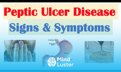 Peptic Ulcer Disease Signs Symptoms Gastric vs Duodenal Ulcers