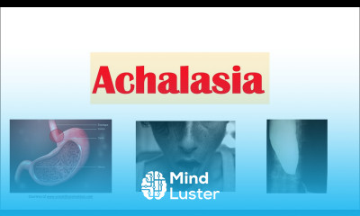 Achalasia Pathophysiology Causes Signs Symptoms Diagnosis Treatment