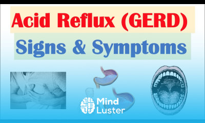 Gastroesophageal Reflux Disease GERD Signs Symptoms ex Bad Teeth Why They Occur