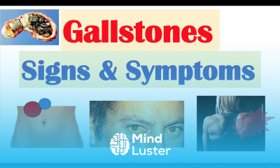 Gallstones Signs Symptoms Why They Occur Cholecystitis Choledocholithiasis Cholangitis