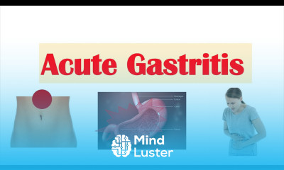 Acute Gastritis Stomach Inflammation Causes Signs Symptoms Diagnosis Treatment