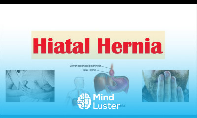 Hiatal Hiatus Hernia Risk Factors Types Signs Symptoms Diagnosis Treatment