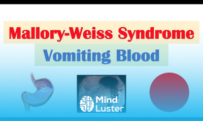 Mallory Weiss Syndrome Tear Risk Factors Causes Signs Symptoms Diagnosis Treatment