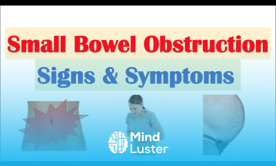 Small Bowel Obstruction SBO Signs Symptoms Why They Occur