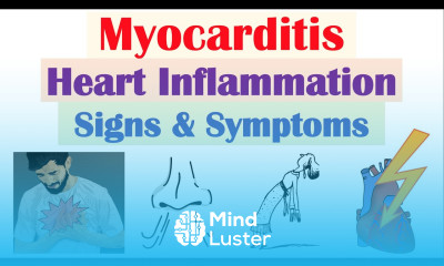 Myocarditis Heart Inflammation Signs Symptoms Why They Occur