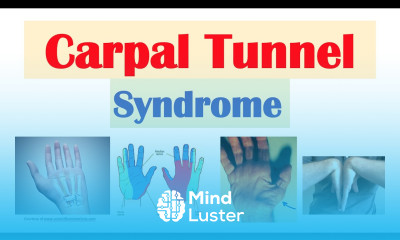 Carpal Tunnel Syndrome Risk Factors Pathogenesis Signs Symptoms Diagnosis Treatment