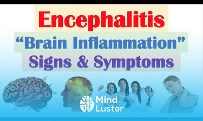 Encephalitis “Brain Inflammation” Signs and Symptoms Why They Occur