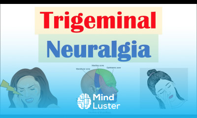 Trigeminal Neuralgia “Severe Facial Pain” Causes Pathophysiology Symptoms Diagnosis Treatment