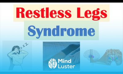 Restless Legs Syndrome RLS Causes Signs Symptoms Diagnosis Treatment