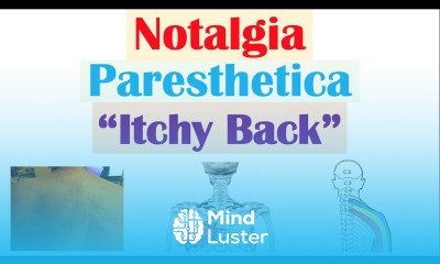 Notalgia Paresthetica “Itchy Back” Causes Risk Factors Symptoms Diagnosis Treatment