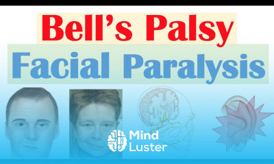 Bell s Palsy Facial Paralysis Causes Pathophysiology Signs Symptoms Diagnosis Treatment
