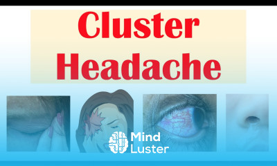 Cluster Headaches Risk Factors Triggers Signs Symptoms Diagnosis Treatment