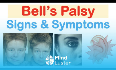 Bell s Palsy Facial Paralysis Signs Symptoms Why They Occur