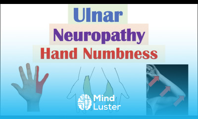 Ulnar Neuropathy Numbness in the Hand Causes Signs Symptoms Diagnosis Treatment