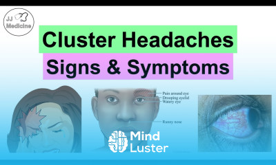 Cluster Headaches Symptoms Associated Issues Triggers